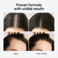 Biotin & Collagen Hair Growth Complex - Bright House