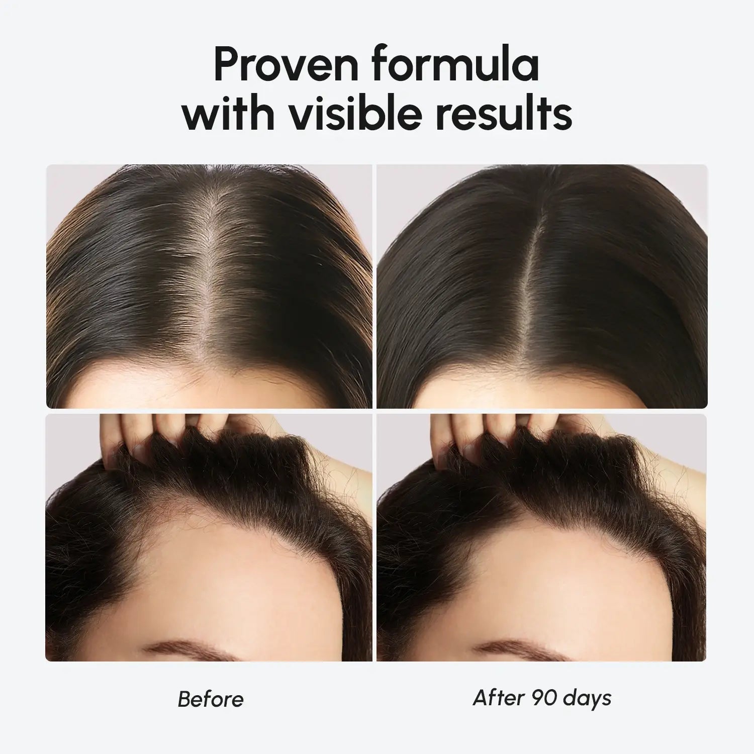 Biotin & Collagen Hair Growth Complex - Bright House