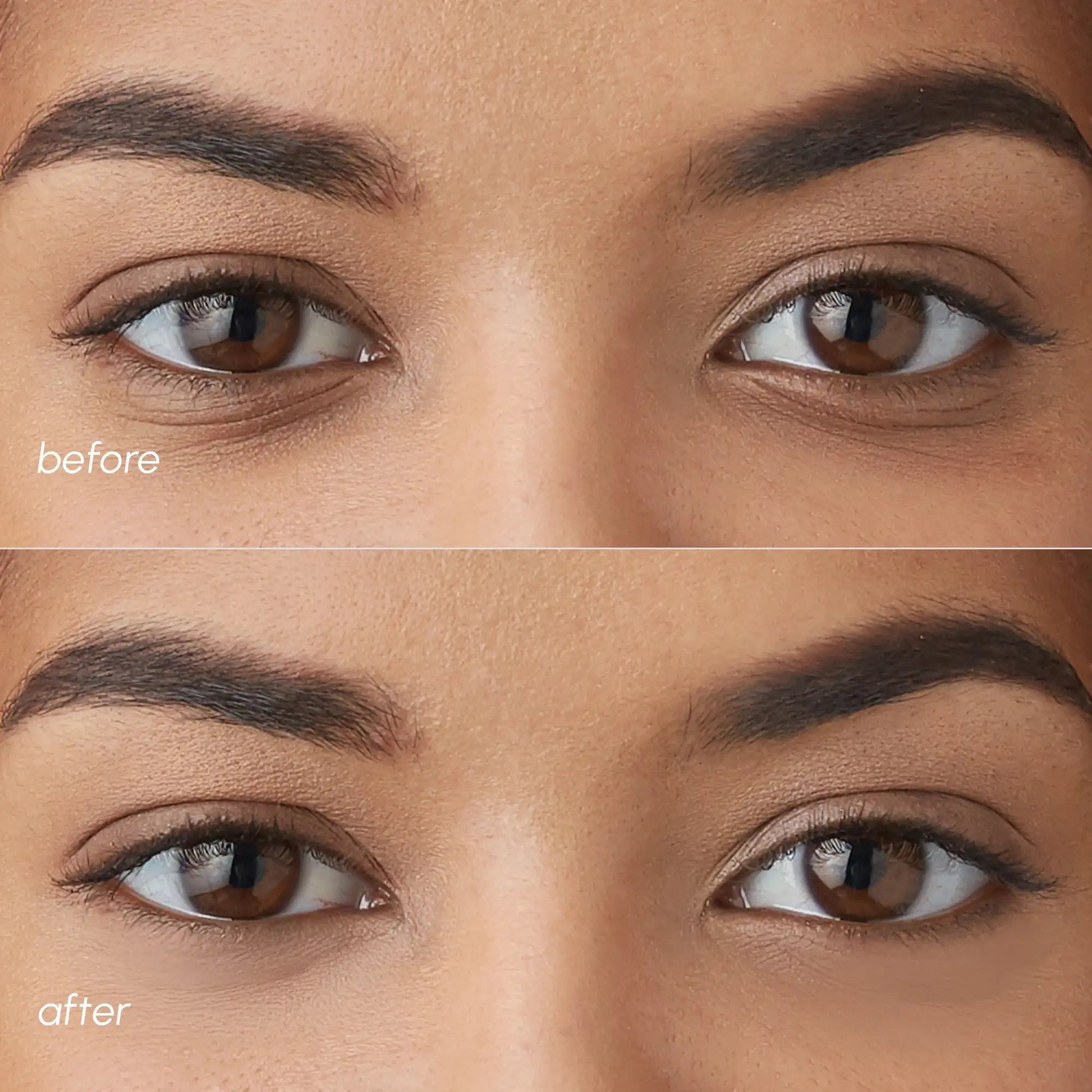 Violet Eye Patches for Dark Circles - Bright House